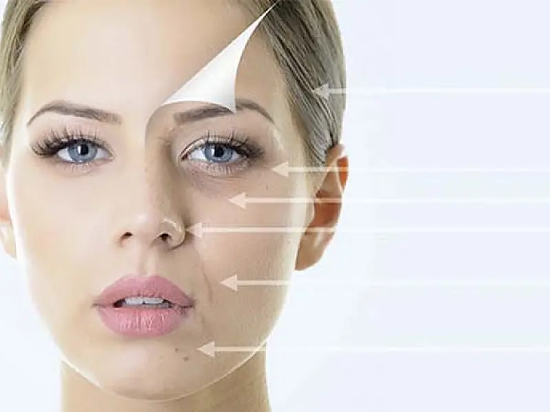 Harmonização Facial deixa o rosto de todo mundo igual? Como evitar os erros mais comuns