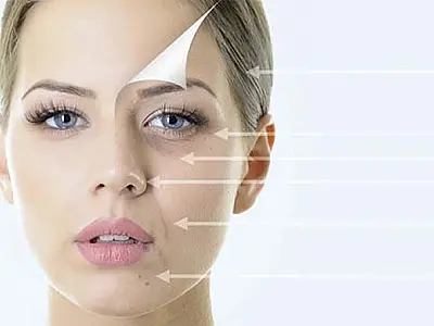 Harmonização Facial deixa o rosto de todo mundo igual? Como evitar os erros mais comuns