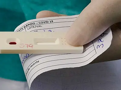 Teste de Covid positivo em farmácia salta de 7% para 20%