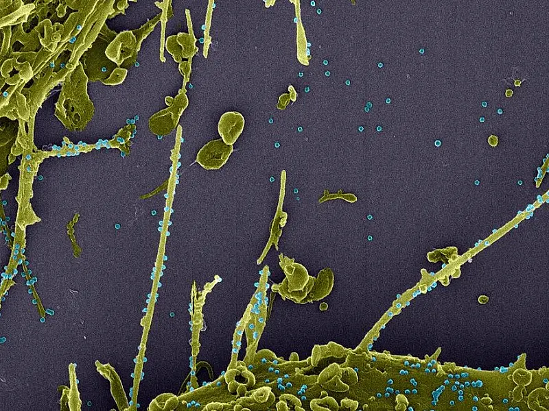 Subvariante da Ômicron é mais infecciosa que "original", diz estudo