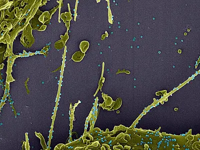 Subvariante da Ômicron é mais infecciosa que "original", diz estudo