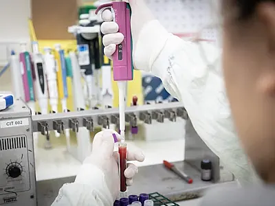Paciente em SP com suspeita de ebola testa positivo para meningite