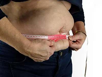 Uma em cada oito pessoas no mundo é obesa, alerta OMS