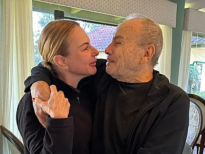 Esposa de Stênio Garcia diz que infecção não tem relação com harmonização facial