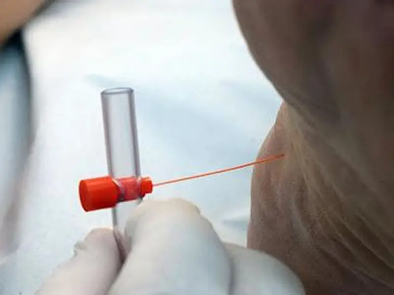Santos acompanha mais de 5 mil pacientes com diagnóstico de diabetes