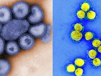 Capital registra 24 casos confirmados de flurona, uma coinfecção por influenza e Covid-19