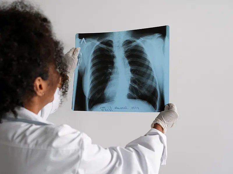UPA Zona Leste alerta para aumento de casos de pneumonia bacteriana no litoral de Santos