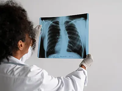 UPA Zona Leste alerta para aumento de casos de pneumonia bacteriana no litoral de Santos