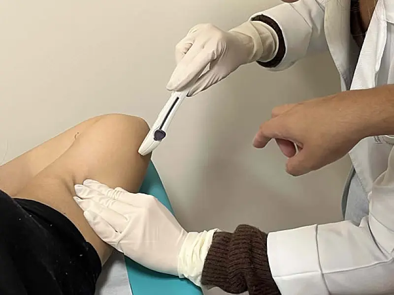 Inscrições para o 7º Mutirão do Implanon encerram nesta segunda (23)