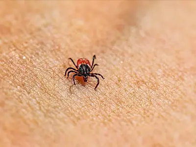 Febre maculosa é um risco em Bertioga? Saiba mais sobre as causas e sintomas