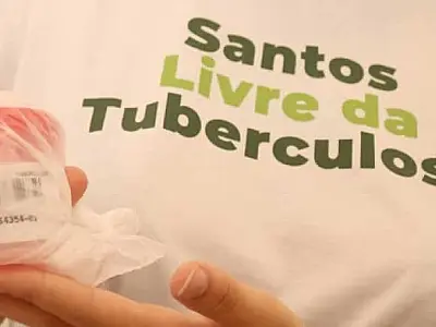 Dia de Combate à Tuberculose: Santos oferece diagnóstico e tratamento