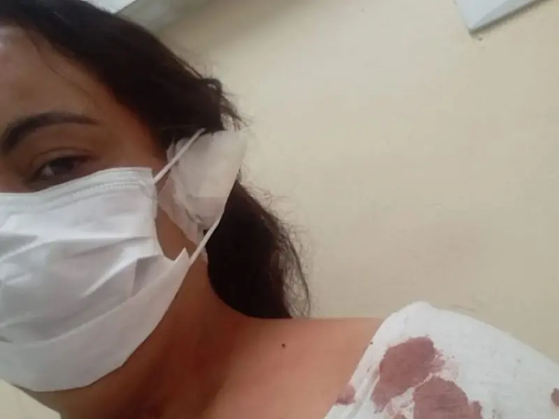 Briga em Bertioga por som alto termina com orelha mordida