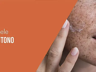 Beleza de estação: tratamentos ideais para cuidar da pele no outono