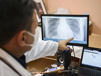 Estudo estima aumento global de 76% dos casos de câncer até 2050