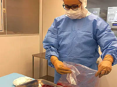 Pesquisa desenvolve curativos biológicos à base de placenta
