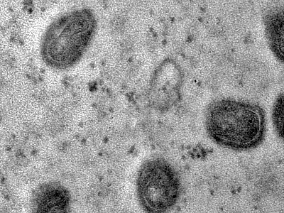 OMS declara fim da emergência em saúde por mpox
