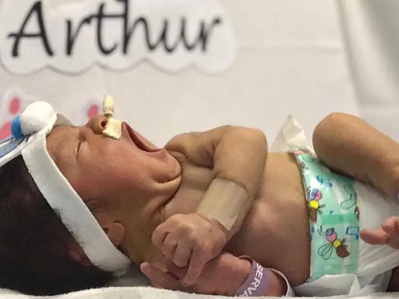 Bebês de UTI de hospital de Santos participam de ensaio fotográfico como coelhinhos da Páscoa