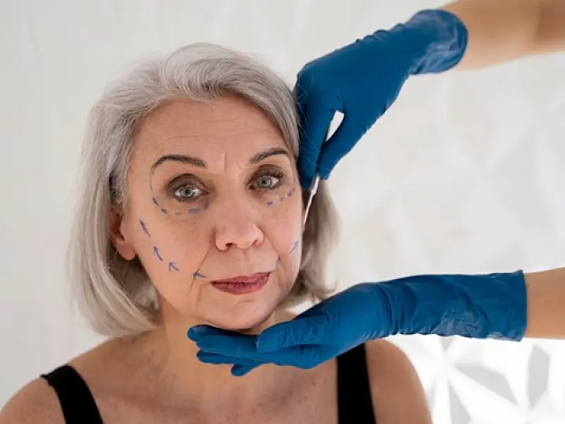 Harmonização facial requer cuidados especiais na terceira idade, explicam especialistas