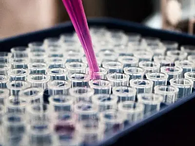 Uso de anti-inflamatório contra Covid reduz pela metade risco de morte um ano após alta, diz estudo