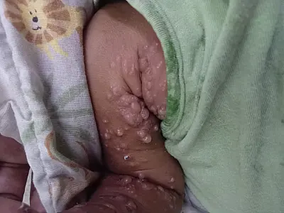 Família solicita ajuda para bebê de cinco meses com doença imunológica no Litoral de SP