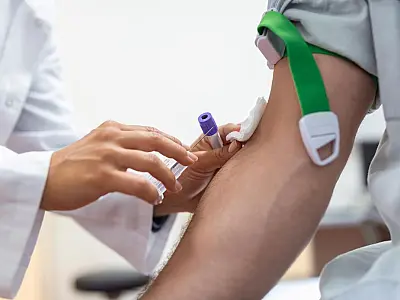 Exames laboratoriais são realizados nas unidades de Saúde nos bairros novamente