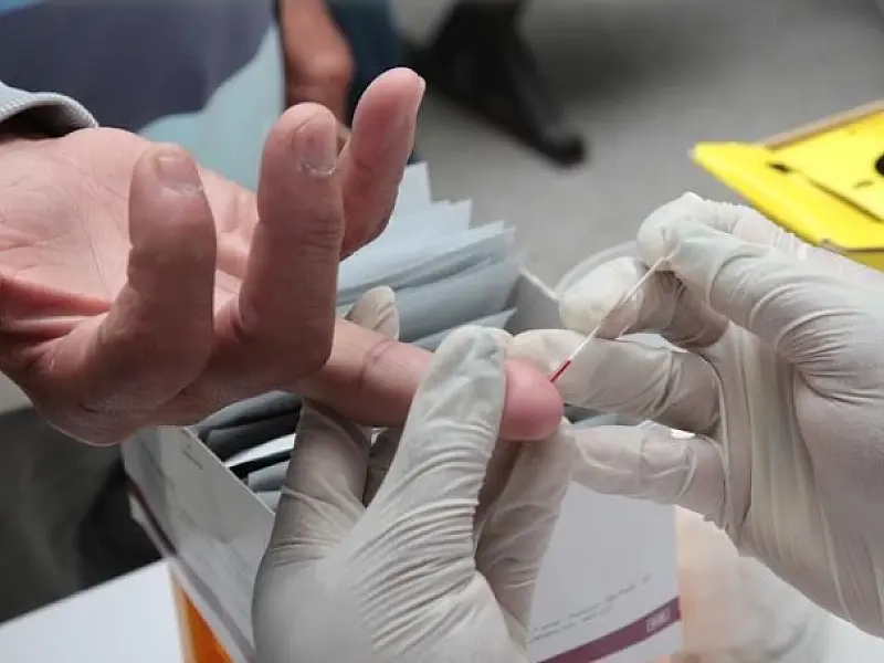 Hospital em Santos oferece testes rápidos de hepatite C