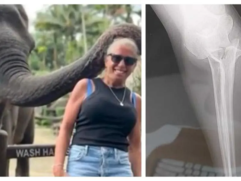 Turista tem braço mordido por elefante e relata pânico