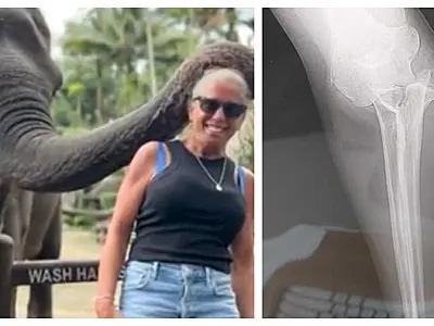 Turista tem braço mordido por elefante e relata pânico
