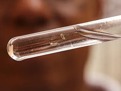 Brasil tem mais de um milhão de casos de dengue este ano