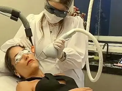 Conheça o Lavieen, a nova tecnologia em laser que trata o melasma e dar o efeito de BB Cream