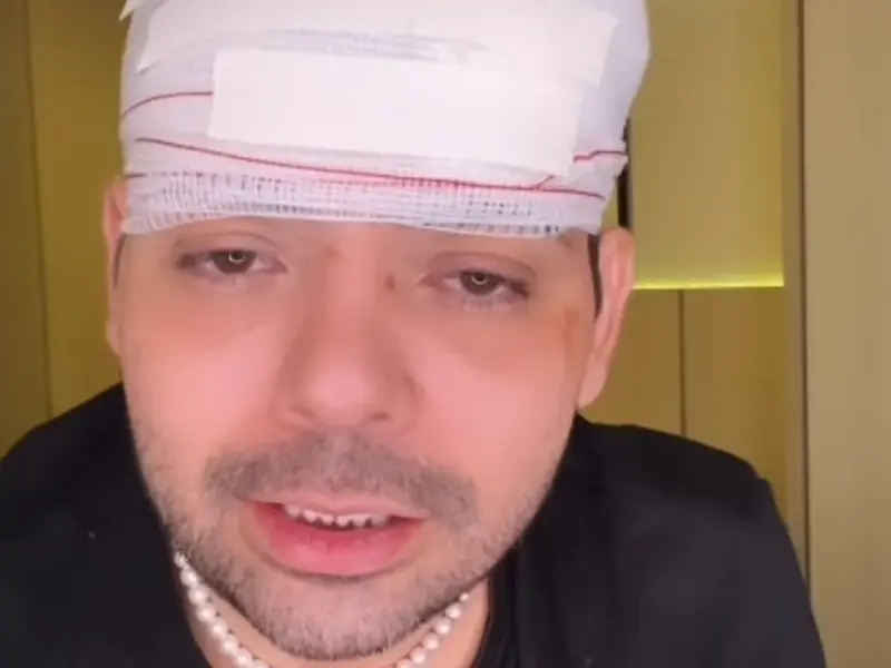 Humorista Gustavo Mendes é agredido em tentativa de assalto