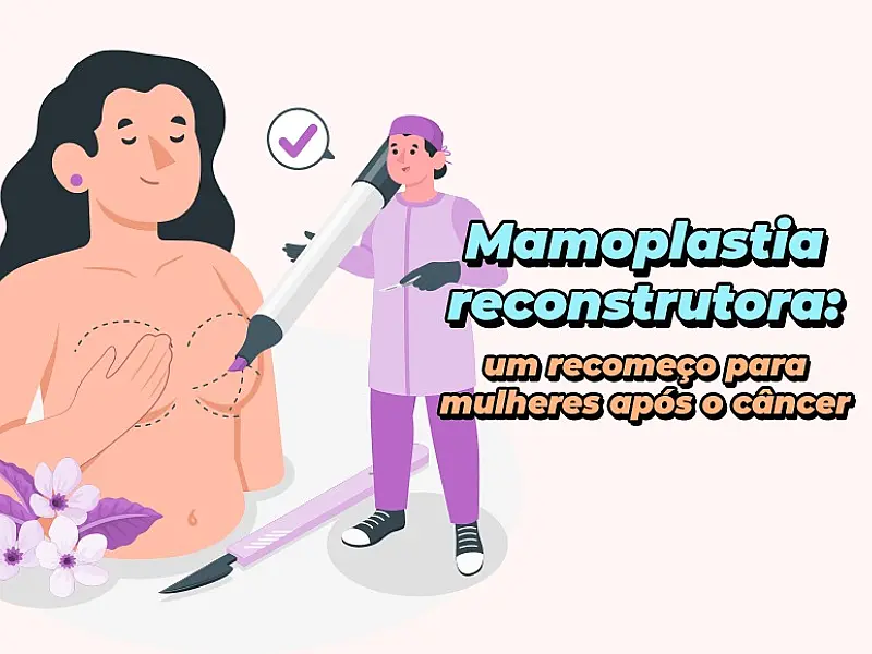 Mamoplastia reconstrutora: um recomeço para mulheres após o câncer.