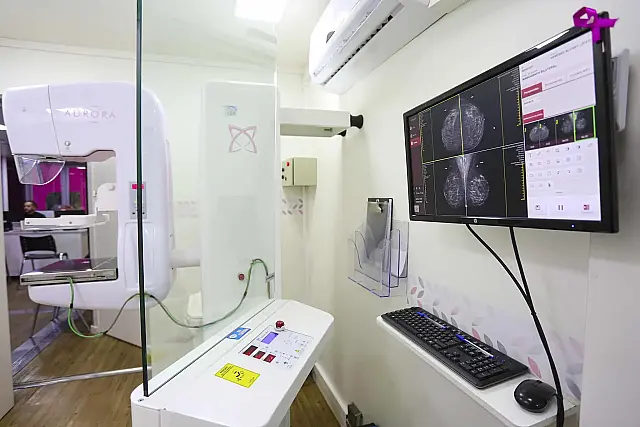Saúde da mulher: SP amplia acesso à mamografia e leva prevenção do câncer de mama para 10 municípios